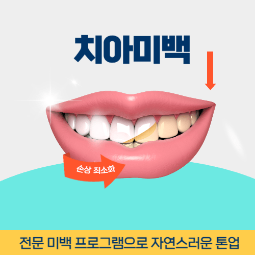 구미치과 구미시 치과 치아미백